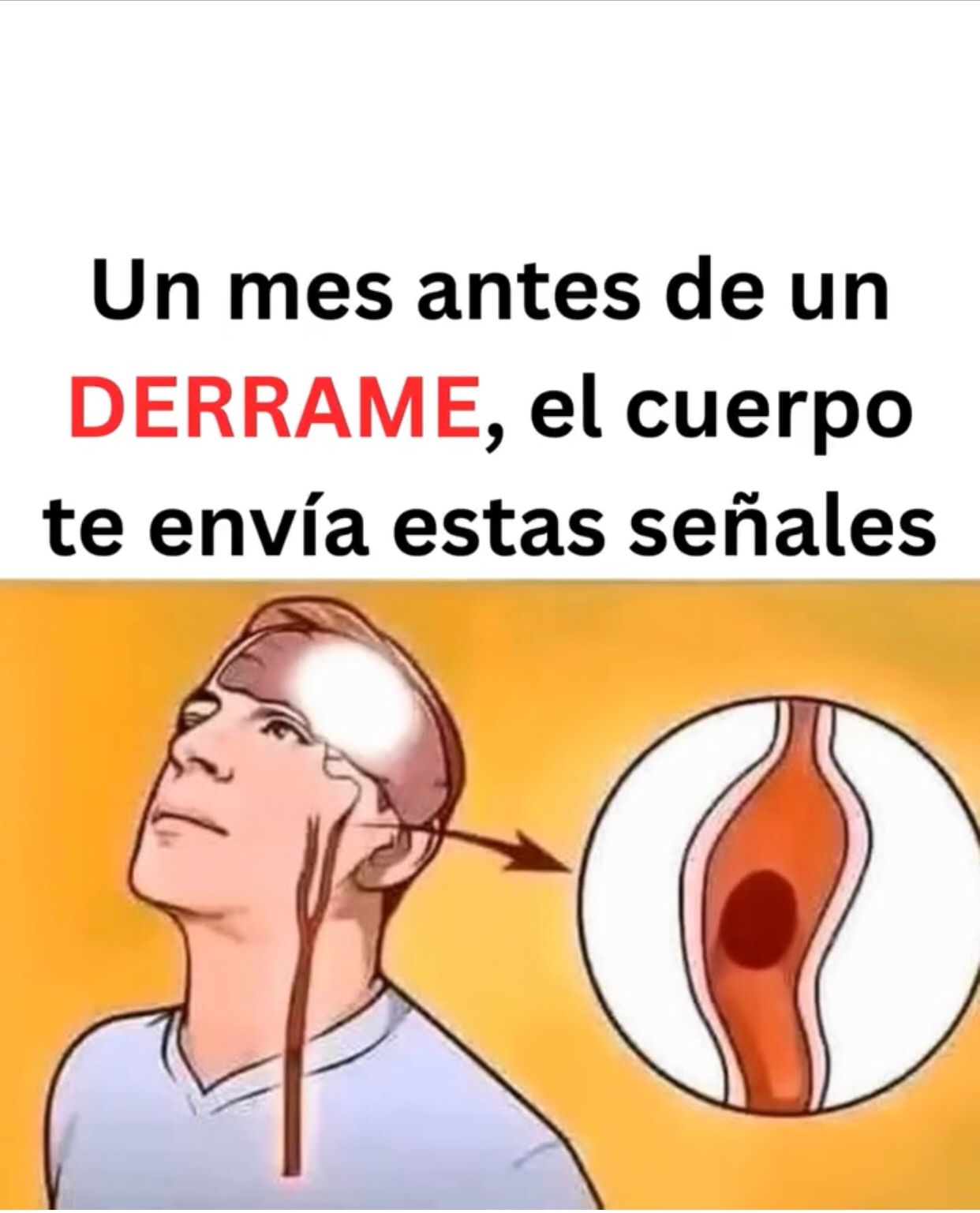 un mes antes el cuerpo te avisa de un posible derrame - Nutricion Vitae
